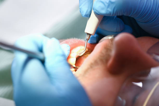 Best Affordable Emergency Dental Care  in Parkers Prairie, MN