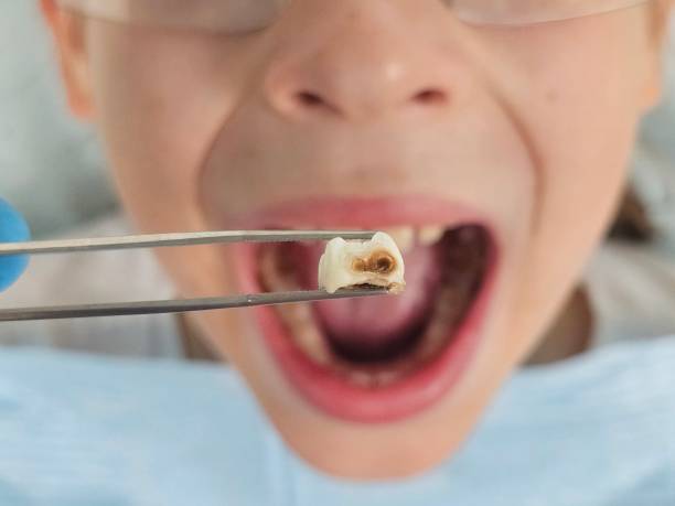 Best Tooth Pain Emergency Relief  in Parkers Prairie, MN